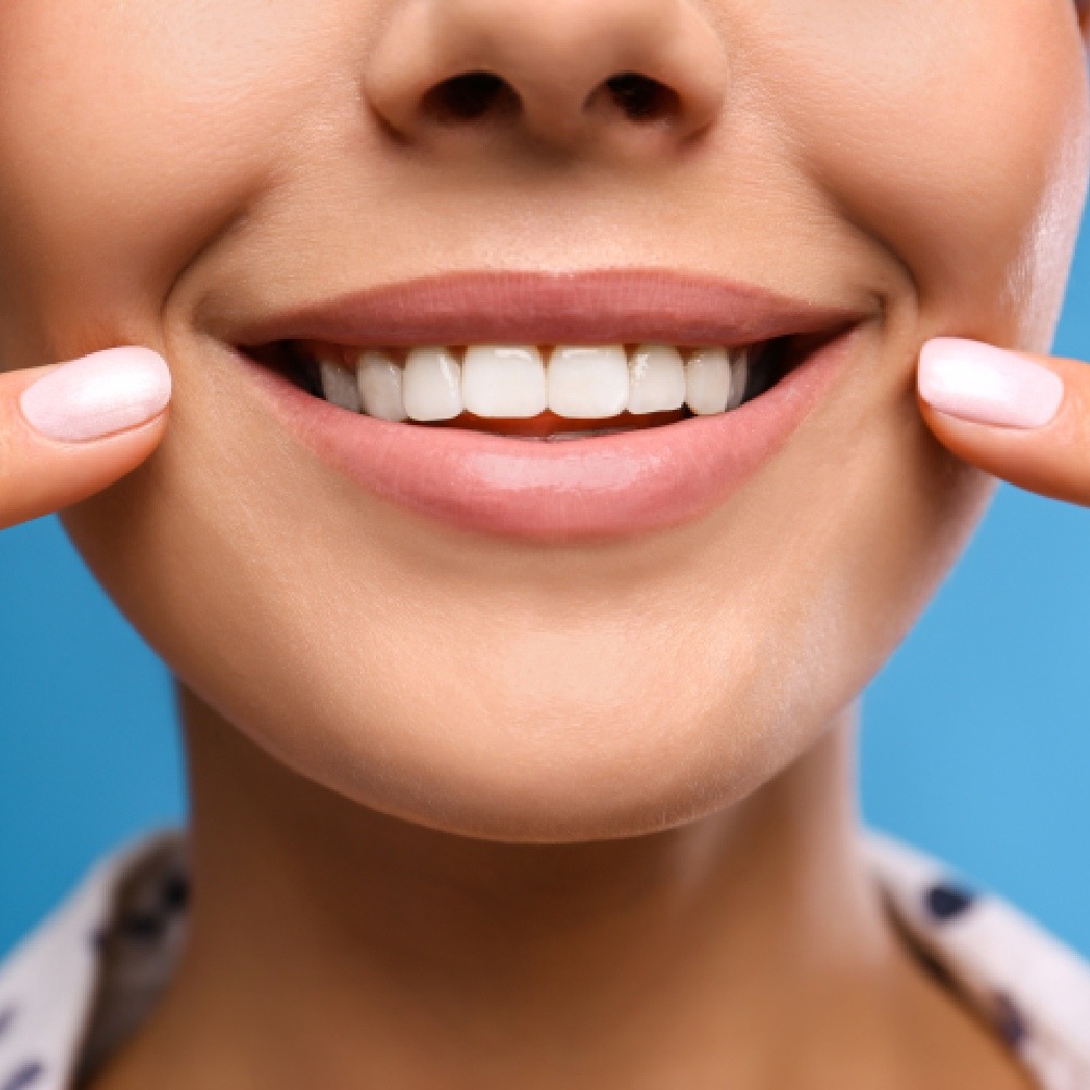 Patient Teeth Whitening