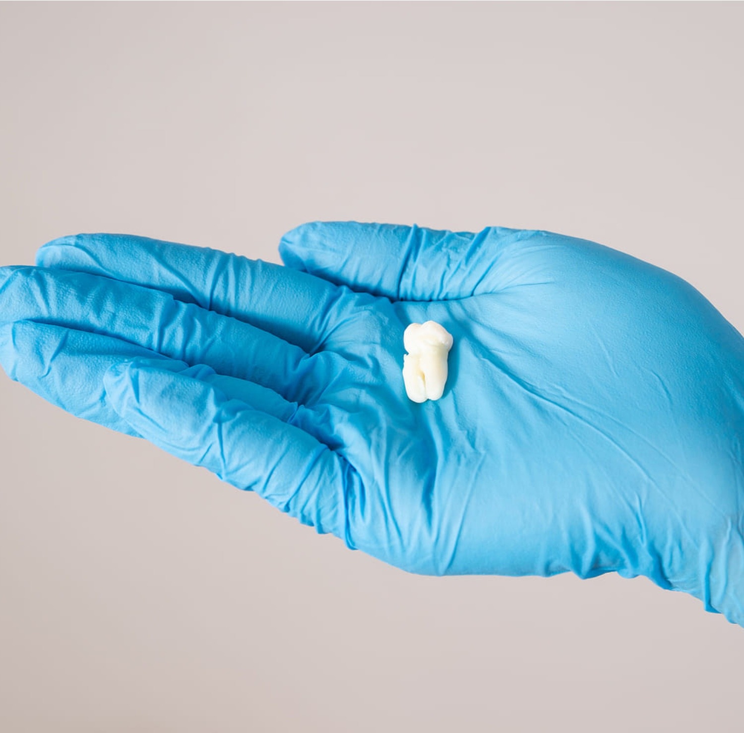 What is tooth extraction